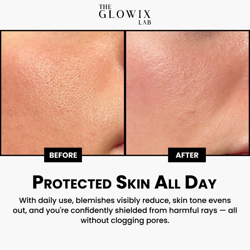 Anti Blemish Sunscreen Broad Spectrum 50 Spf - Image 5