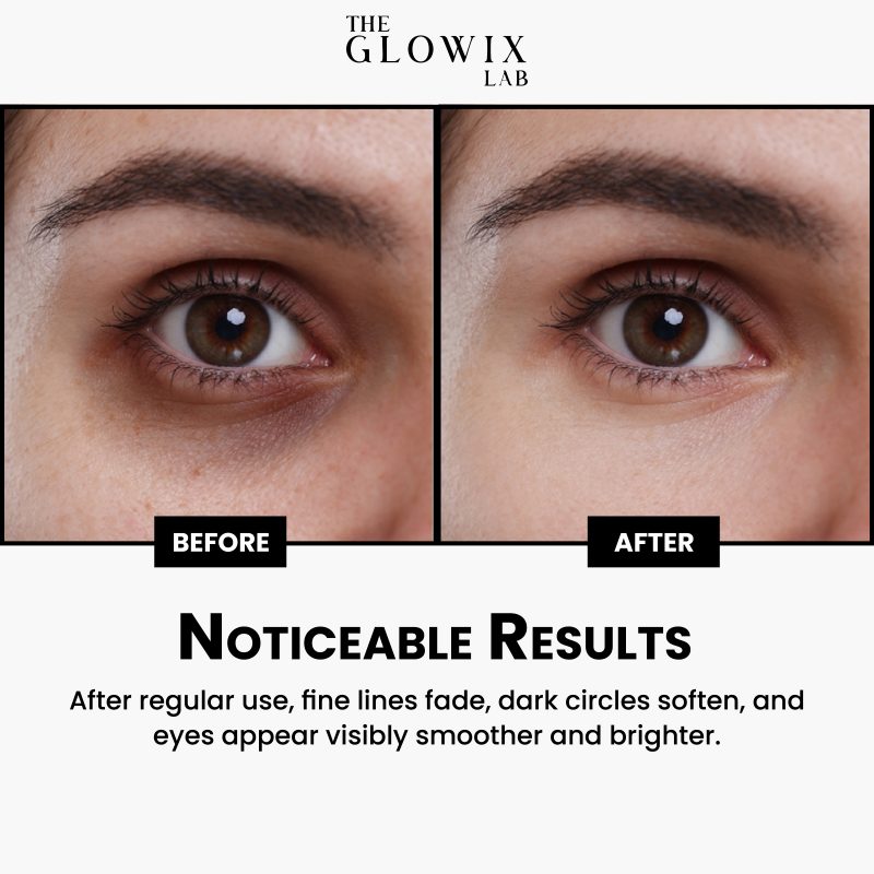 Eye Contour Cream - Image 5