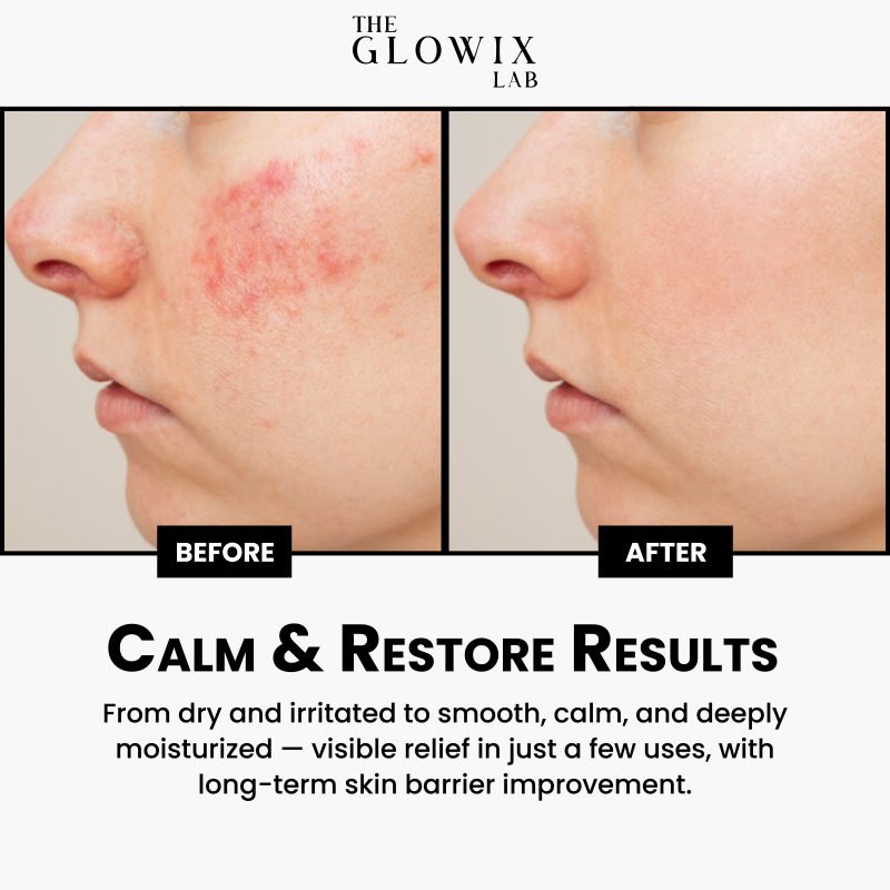 Intense Repair & Moisturizer Cream Cica Cream - Image 5