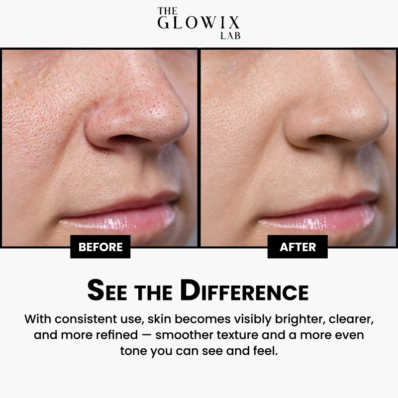 Facial Peeling Serum - Image 5