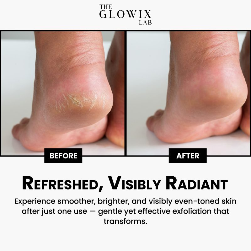 Coenzyme Qio Peeling Gel - Image 5