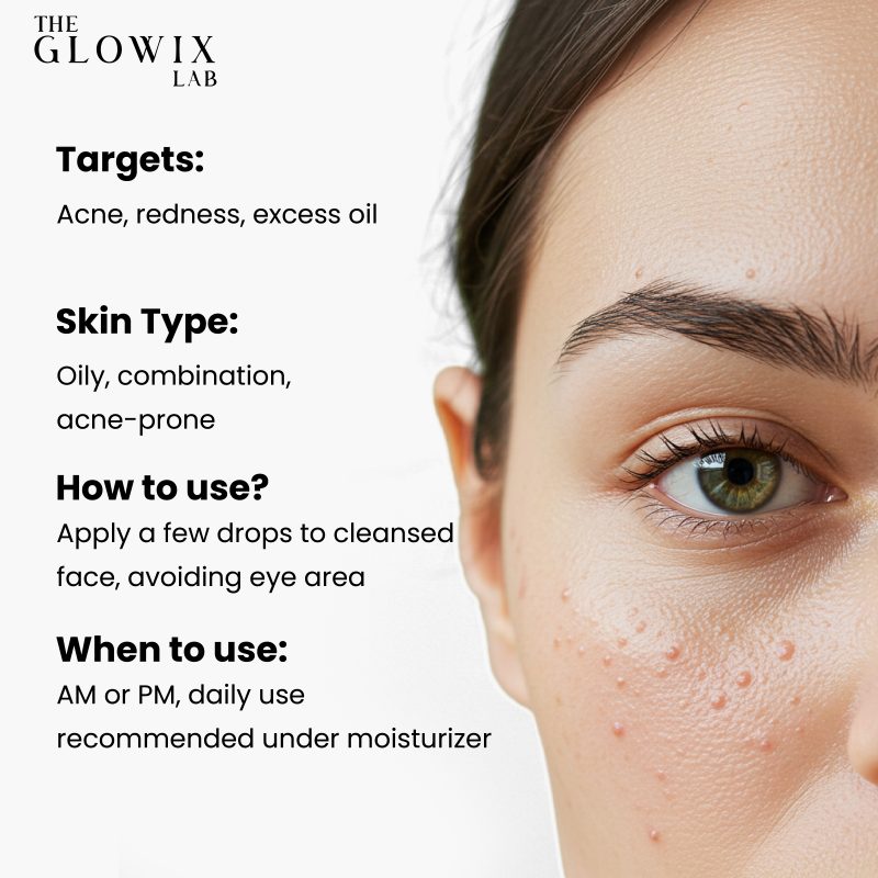 Anti Acne Serum - Image 6